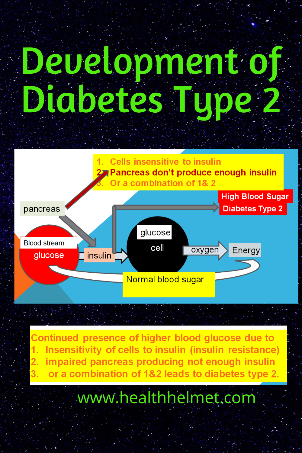 Development-of-type-2-diabetes